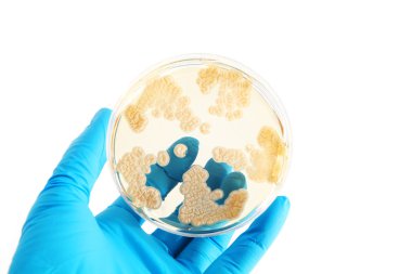 fungi microorganisms on agar plate clipart