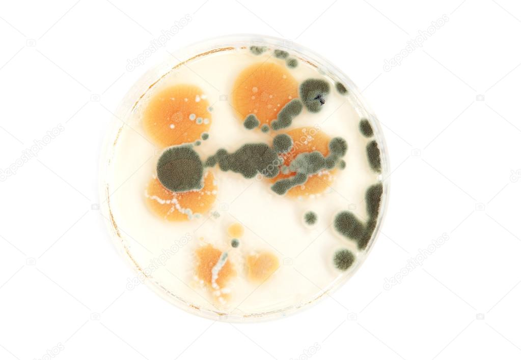 various fungi on agar plate