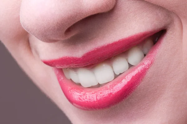 Dentes brancos e um belo sorriso, close-up — Fotografia de Stock