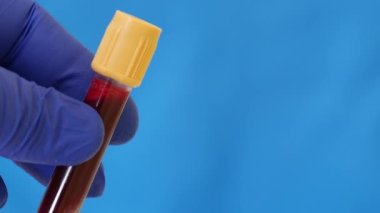 İnsan kanı konteynırı. Mavi nitrile eldiveni içinde kan olan test tüpü taşıyor.