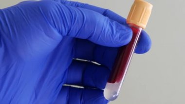 İnsan kanı konteynırı. Mavi nitrile eldiveni içinde kan olan test tüpü taşıyor.