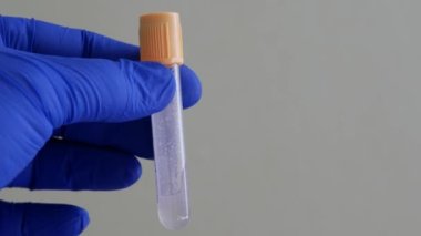 Kan toplama konteynırı. Mavi nitril eldiveni verin. Boş kan test tüpü