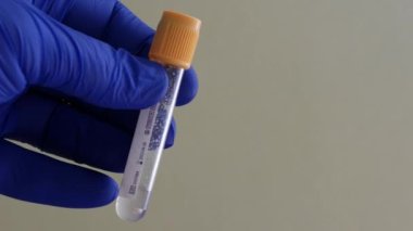 Kan toplama konteynırı. Mavi nitril eldiveni verin. Boş kan test tüpü