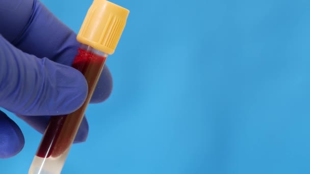 Kontejner s lidskou krví. Ruka v modré nitrilové rukavici drží zkumavku s krví — Stock video