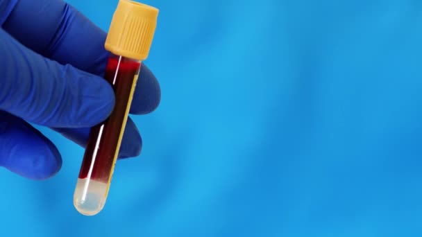 Kontejner s lidskou krví. Ruka v modré nitrilové rukavici drží zkumavku s krví — Stock video