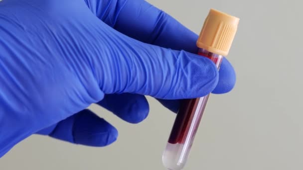 Container of human blood. Hand in blue nitrile glove holds test tube with blood — Video Stock