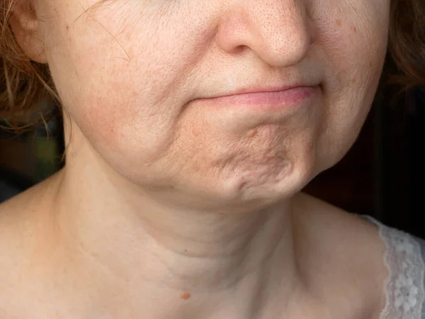 Facial Expression Female Looking Disgusted Negative Emotion Macro Closeup — Stock fotografie