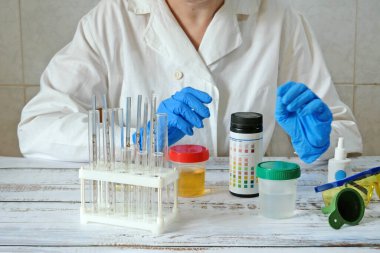 Doktor sıvılarla test tüpü alıyor, idrarla test ediyor, bilim adamı doktor test tüpünden numuneye bakıyor. Laboratuvar analizi. Yakın çekim.