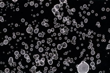 Karanlık soyut dokulu arka planlar. Lekeler ve lekeler. Alkol mürekkebi.