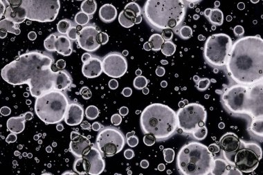 Karanlık soyut dokulu arka planlar. Lekeler ve lekeler. Alkol mürekkebi.