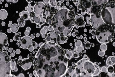 Karanlık soyut dokulu arka planlar. Lekeler ve lekeler. Alkol mürekkebi.