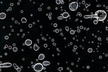 Karanlık soyut dokulu arka planlar. Lekeler ve lekeler. Alkol mürekkebi.