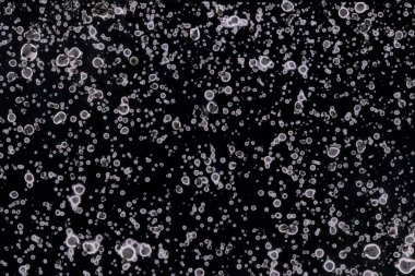 Karanlık soyut dokulu arka planlar. Lekeler ve lekeler. Alkol mürekkebi.