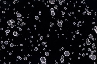 Karanlık soyut dokulu arka planlar. Lekeler ve lekeler. Alkol mürekkebi.