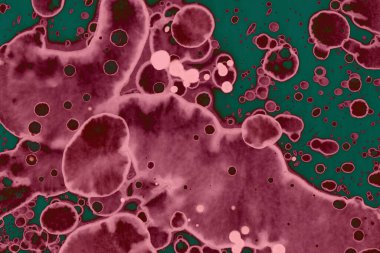 Soyut dokulu arka planlar. Lekeler ve lekeler. Alkol mürekkebi pembe ve yeşil.