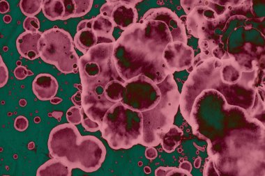 Soyut dokulu arka planlar. Lekeler ve lekeler. Alkol mürekkebi pembe ve yeşil.