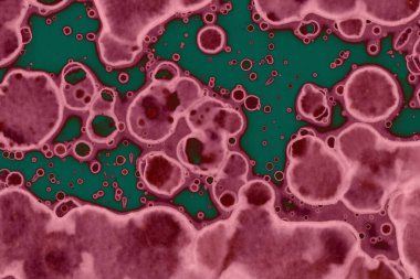 Soyut dokulu arka planlar. Lekeler ve lekeler. Alkol mürekkebi pembe ve yeşil.