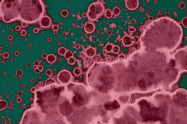 Soyut dokulu arka planlar. Lekeler ve lekeler. Alkol mürekkebi pembe ve yeşil.