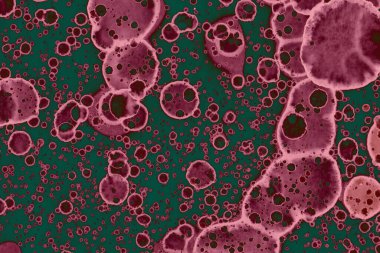 Soyut dokulu arka planlar. Lekeler ve lekeler. Alkol mürekkebi pembe ve yeşil.