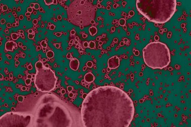 Soyut dokulu arka planlar. Lekeler ve lekeler. Alkol mürekkebi pembe ve yeşil.