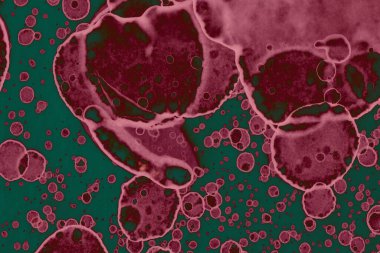 Soyut dokulu arka planlar. Lekeler ve lekeler. Alkol mürekkebi pembe ve yeşil.