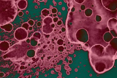 Soyut dokulu arka planlar. Lekeler ve lekeler. Alkol mürekkebi pembe ve yeşil.