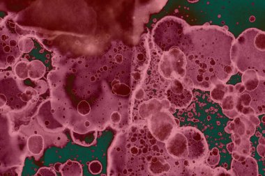 Soyut dokulu arka planlar. Lekeler ve lekeler. Alkol mürekkebi pembe ve yeşil.