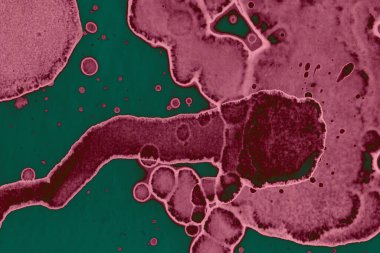 Soyut dokulu arka planlar. Lekeler ve lekeler. Alkol mürekkebi pembe ve yeşil.