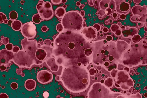 Soyut dokulu arka planlar. Lekeler ve lekeler. Alkol mürekkebi pembe ve yeşil.