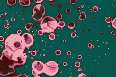 Soyut dokulu arka planlar. Lekeler ve lekeler. Alkol mürekkebi pembe ve yeşil.