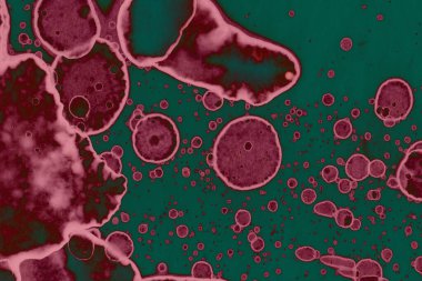 Soyut dokulu arka planlar. Lekeler ve lekeler. Alkol mürekkebi pembe ve yeşil.