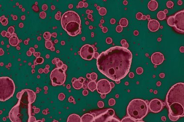 Soyut dokulu arka planlar. Lekeler ve lekeler. Alkol mürekkebi pembe ve yeşil.