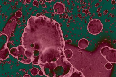 Soyut dokulu arka planlar. Lekeler ve lekeler. Alkol mürekkebi pembe ve yeşil.