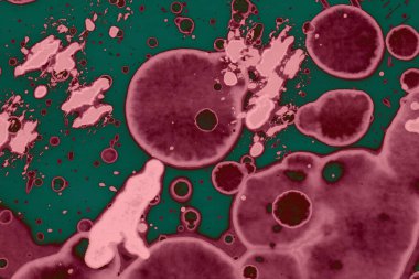 Soyut dokulu arka planlar. Lekeler ve lekeler. Alkol mürekkebi pembe ve yeşil.