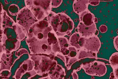 Soyut dokulu arka planlar. Lekeler ve lekeler. Alkol mürekkebi pembe ve yeşil.