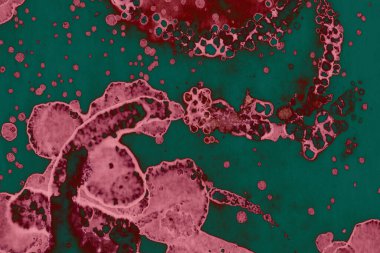 Soyut dokulu arka planlar. Lekeler ve lekeler. Alkol mürekkebi pembe ve yeşil.