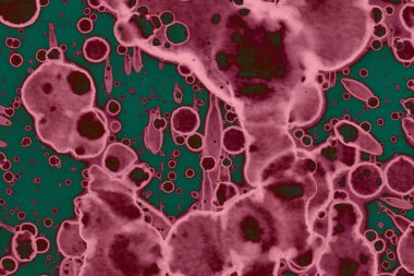 Soyut dokulu arka planlar. Lekeler ve lekeler. Alkol mürekkebi pembe ve yeşil.