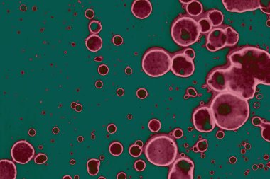 Soyut dokulu arka planlar. Lekeler ve lekeler. Alkol mürekkebi pembe ve yeşil.