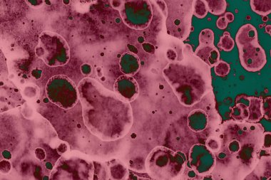 Soyut dokulu arka planlar. Lekeler ve lekeler. Alkol mürekkebi pembe ve yeşil.