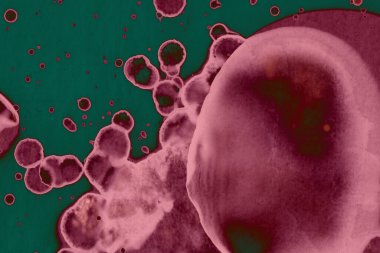 Soyut dokulu arka planlar. Lekeler ve lekeler. Alkol mürekkebi pembe ve yeşil.