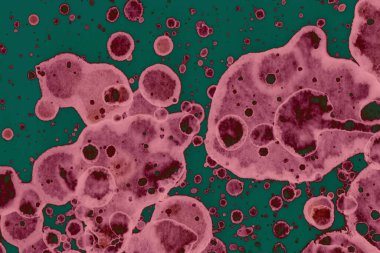 Soyut dokulu arka planlar. Lekeler ve lekeler. Alkol mürekkebi pembe ve yeşil.