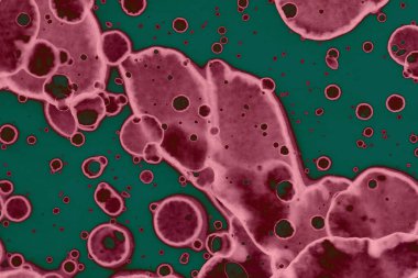 Soyut dokulu arka planlar. Lekeler ve lekeler. Alkol mürekkebi pembe ve yeşil.