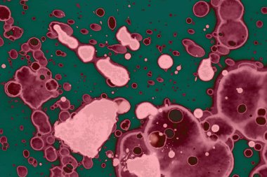 Soyut dokulu arka planlar. Lekeler ve lekeler. Alkol mürekkebi pembe ve yeşil.