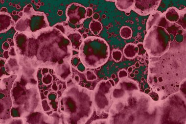 Soyut dokulu arka planlar. Lekeler ve lekeler. Alkol mürekkebi pembe ve yeşil.