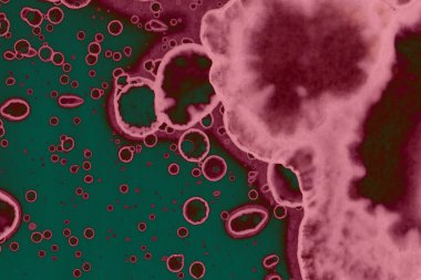 Soyut dokulu arka planlar. Lekeler ve lekeler. Alkol mürekkebi pembe ve yeşil.