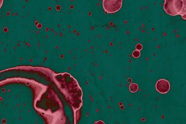 Soyut dokulu arka planlar. Lekeler ve lekeler. Alkol mürekkebi pembe ve yeşil.