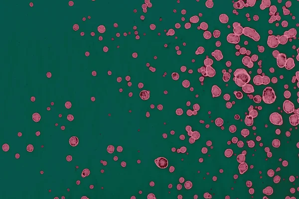 Абстрактні Текстуровані Фони Блоки Плями Алкогольне Чорнило Рожеве Зелене — стокове фото