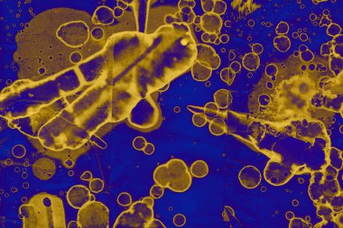 Soyut mavi sarı arka plan. Lekeler ve kabarcıklar. Alkol mürekkebi sanatı. Sembol.