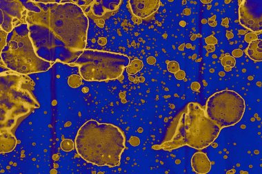 Soyut mavi sarı arka plan. Lekeler ve kabarcıklar. Alkol mürekkebi sanatı. Sembol.