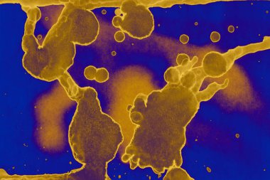 Soyut mavi sarı arka plan. Lekeler ve kabarcıklar. Alkol mürekkebi sanatı. Sembol.